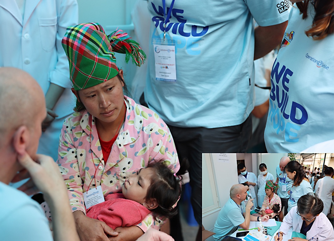 lady holdinh child for cleft lip operation restore hope 2025